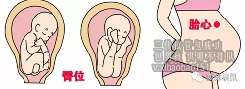 郑州供卵代孕包生子，标本采集患者身份确认制度