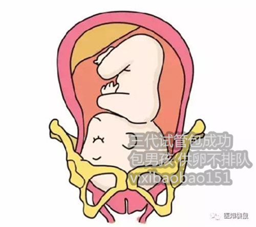 郑州专业代生，腺肌症子宫增大适合做几代试管婴儿？